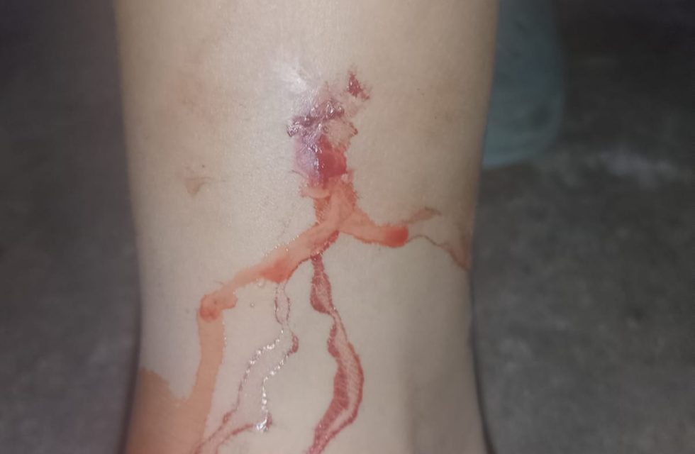 la pierna del menor.